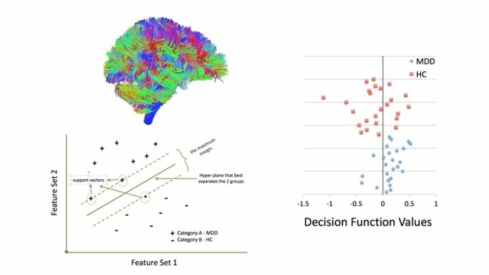 Machine Learning on Stampede2 Supercomputer to Bolster Brain Research